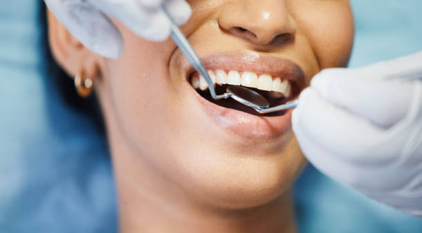 Best Emergency Dental Extractions in Laflin, PA