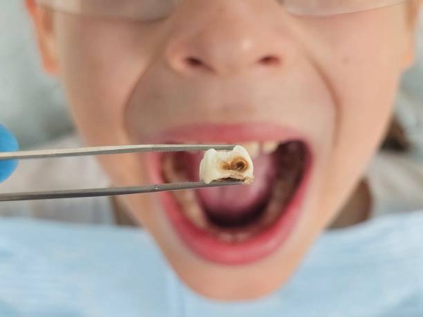 Best Weekend Emergency Dentist in Laflin, PA